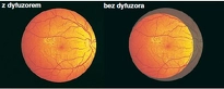 Oftalmoskop pośredni All Pupil II - jakość obrazu